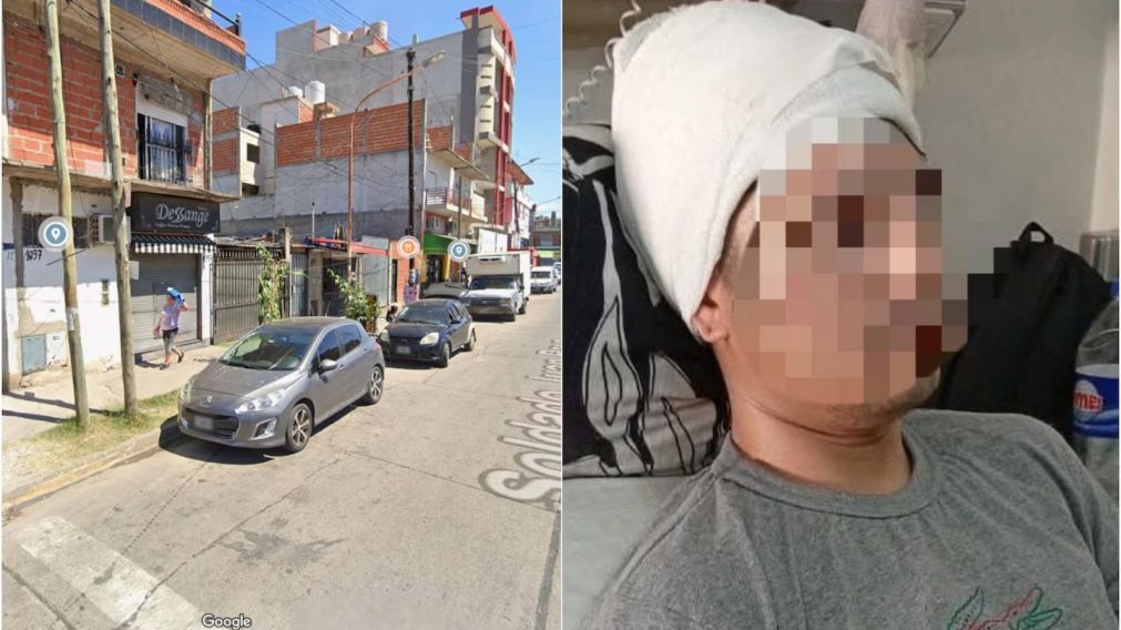 Un joven fue operado de urgencia tras un ataque arriba de un colectivo, estuvo internado y ahora se está recuperando.
