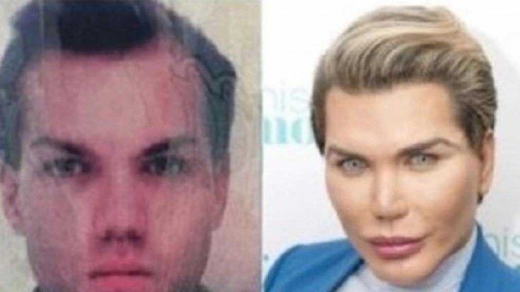 El "Ken humano", con problemas de imagen