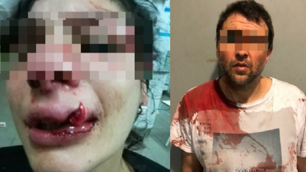La mujer recibió una brutal golpiza de su novio.