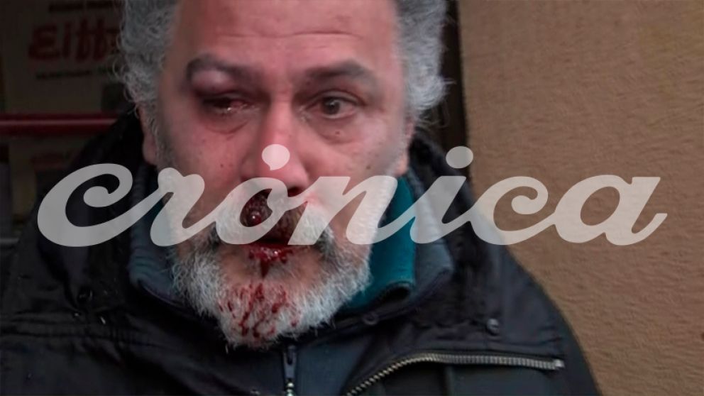 El agresor resultó gravemente herido. (Captura).