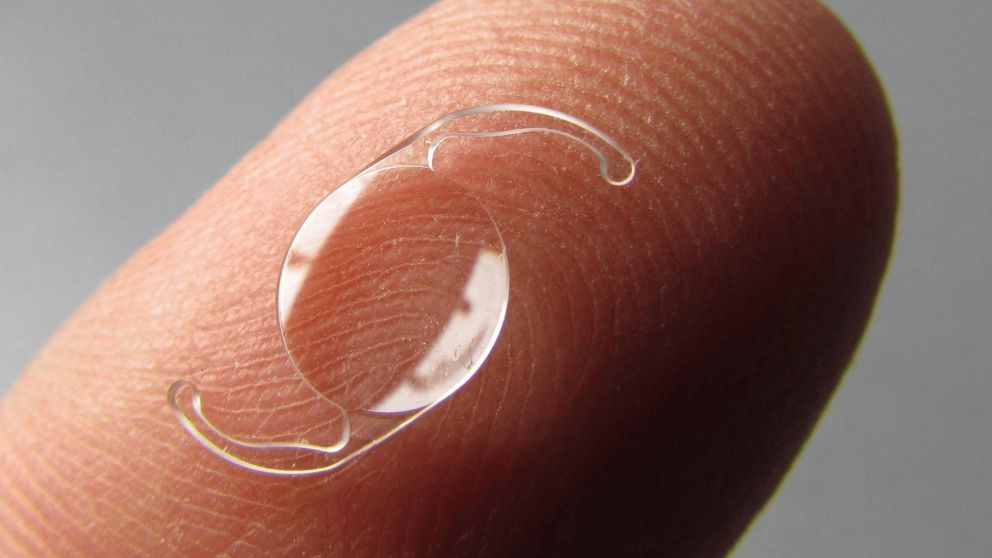 PAMI dijo que no existen sobreprecios en la compra de lentes intraoculares