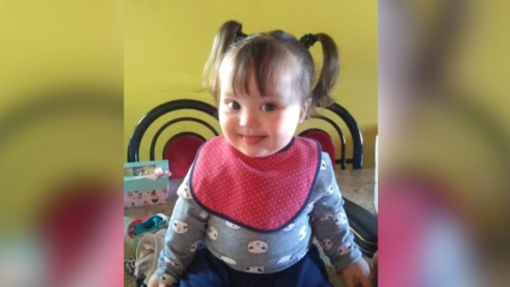 La pequeña tiene que ser intervenida por un problema congénito.