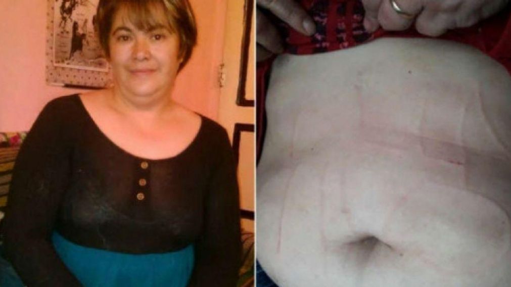 La docente secuestrada y su abdomen tajeado.