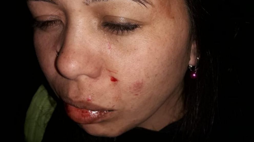 Pastores molieron a golpes a una de sus fieles