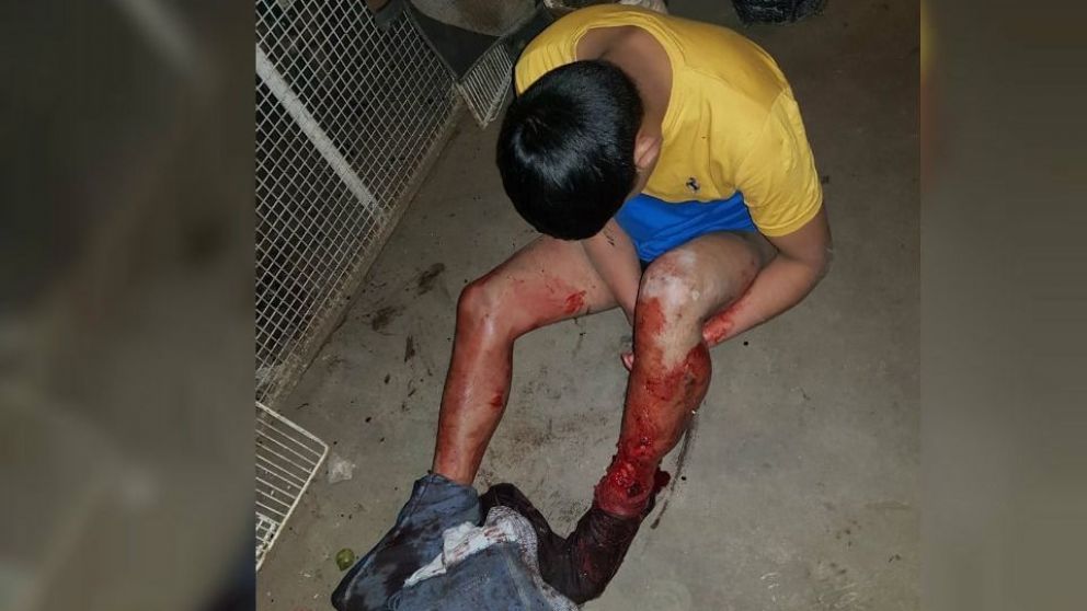 El pitbull vio ingresar al asaltante y le provocó una gran herida en la pierna.