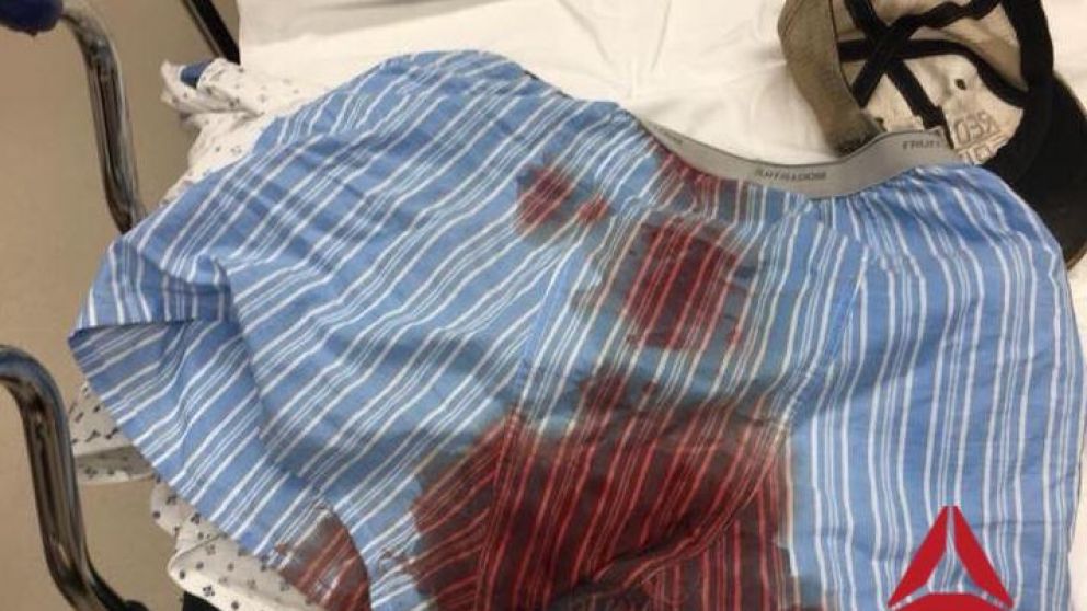 Tras llegar al hospital, el luchador fotografió su calzoncillo con sangre.