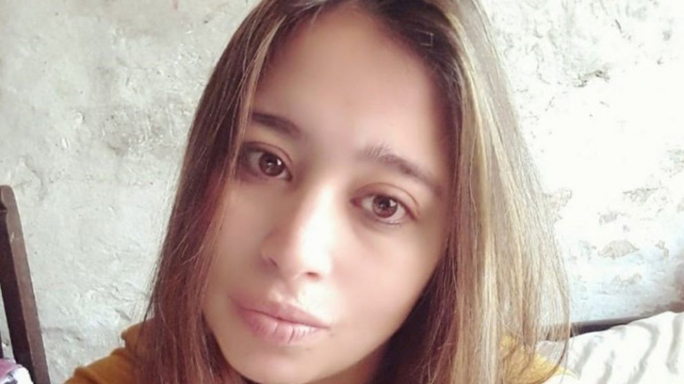 Romina Flores, falleció al mes de ser operada.