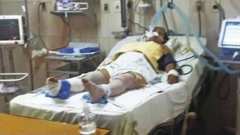 La mujer está en terapia pero está fuera de peligro.