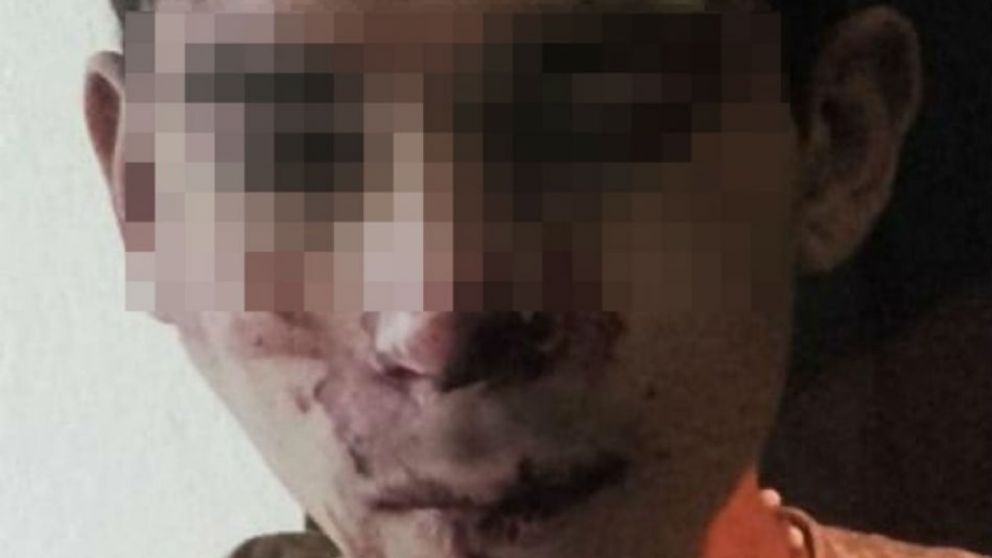 Este es el joven motochorro de 18 años, que está detenido por ambos casos.