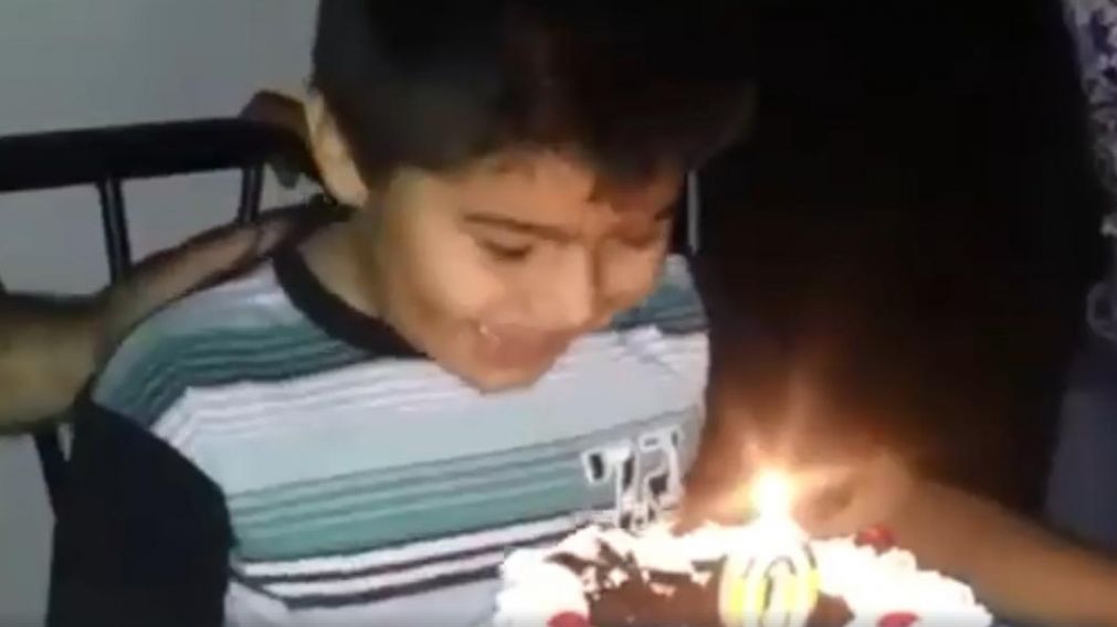 Mordió torta de cumple y se le prendió fuego la cabeza