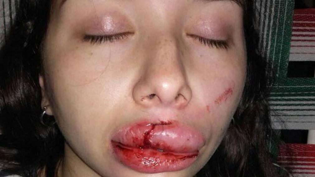 Así quedó la joven tras la paliza recibida (Facebook).