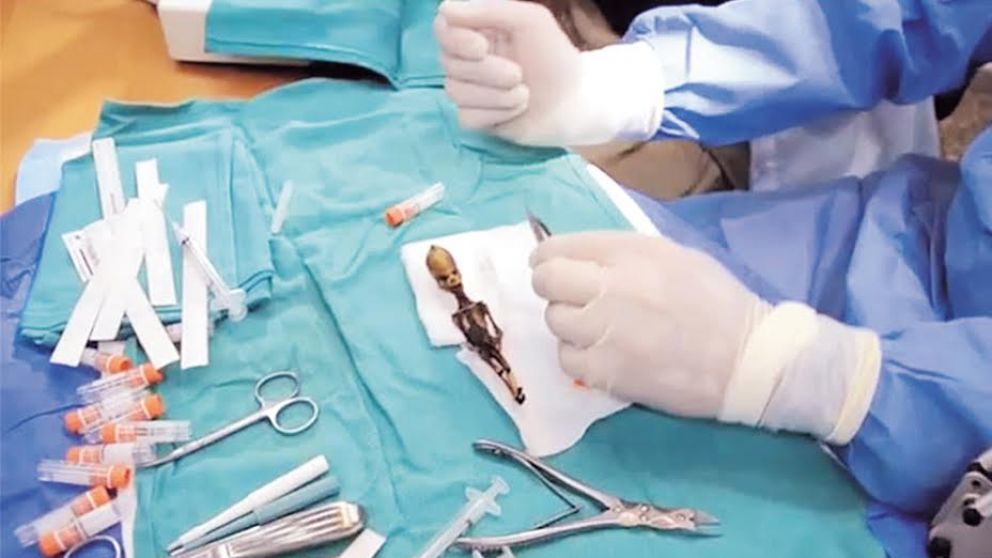 El diminuto ser hallado en la aldea rusa no tenía características humanas ni de algún animal específico.