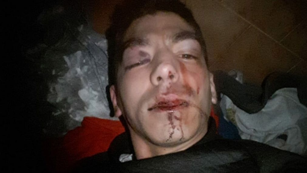Hatano Kiyoshi, de 32 años, sufrió una paliza por parte de patovicas.