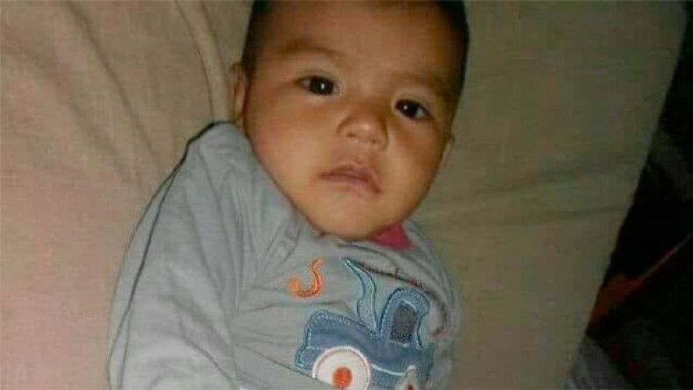 Thiago tiene fractura de cráneo y confusión pulmonar.