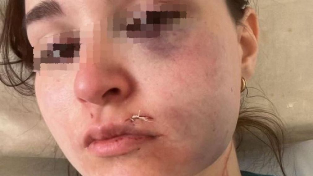 Atac� a su pareja, a su hija de 17 meses y a su suegra: intensa b�squeda del agresor