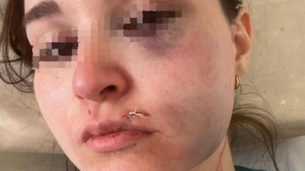 Atacó a su pareja, a su hija de 17 meses y a su suegra: intensa búsqueda del agresor