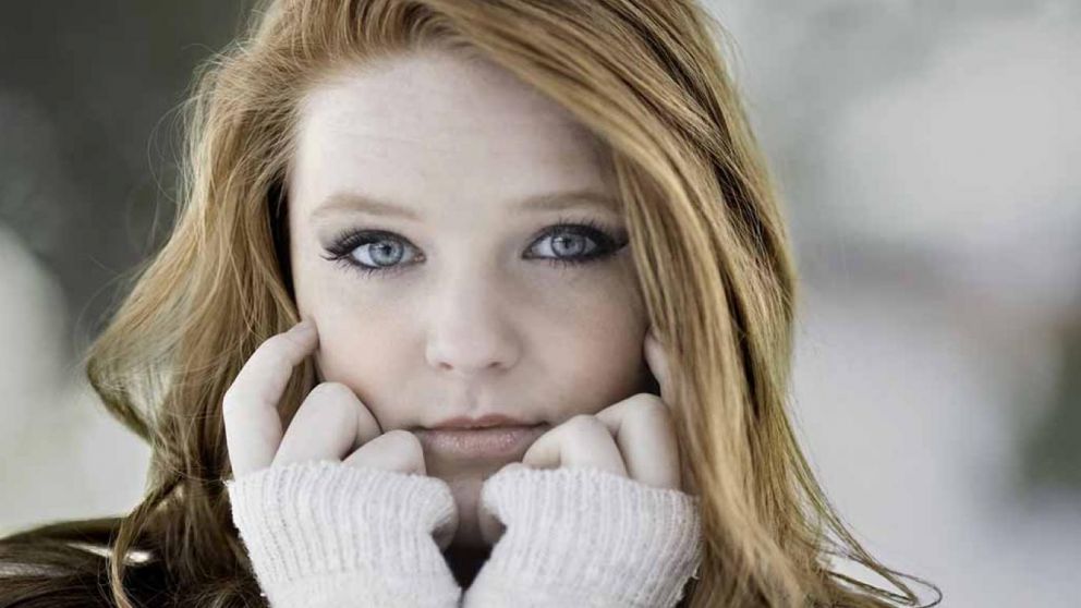 Es fundamental cuidar la piel en invierno.