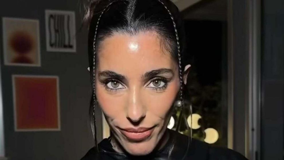 Catalina Gorostidi apareci� en redes con la cara hinchada y preocup� a todos. (Foto: Instagram/ @catigorostidi).