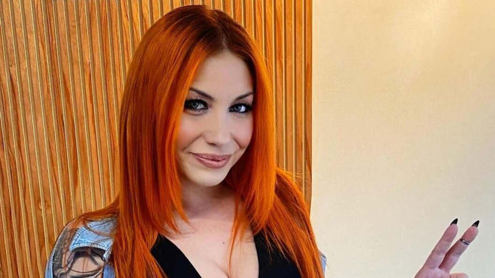 Tras la cirug�a, Lourdes Fern�ndez comparti� detalles de su recuperaci�n. (Foto: Instagram/ @lowrdez).