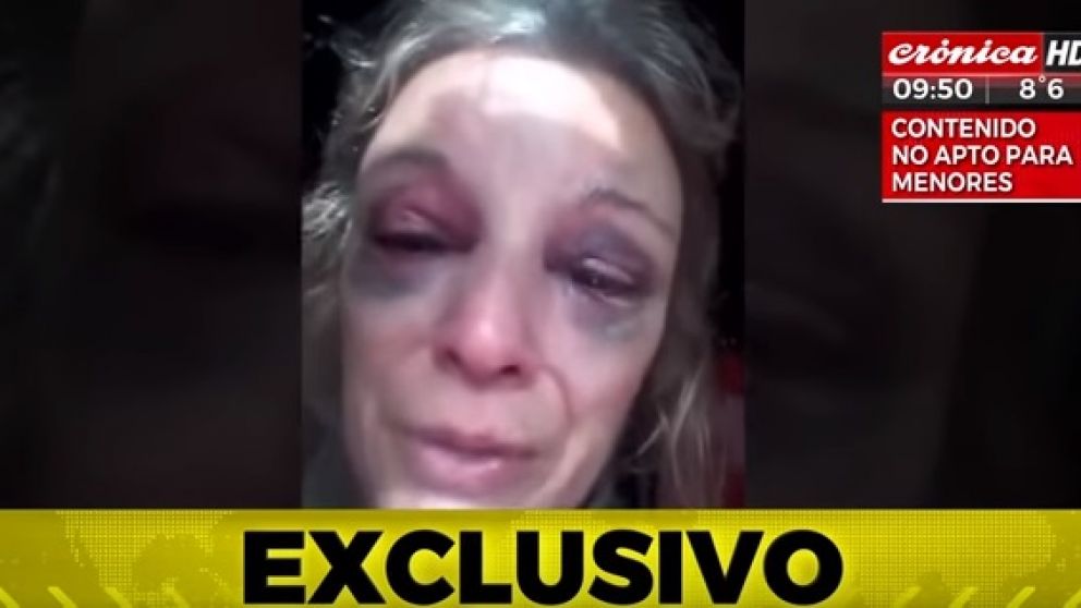 Así se pudo ver a la mujer que fue brutalmente agredida. (Captura de video).