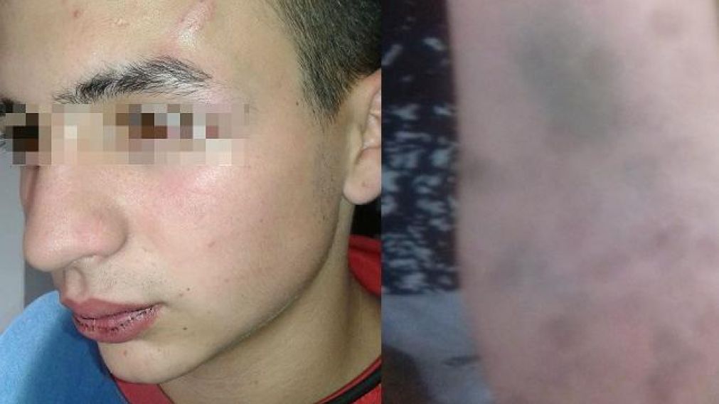 Policías noquearon a pibe de 16, se lo llevaron y lo torturaron "por error"