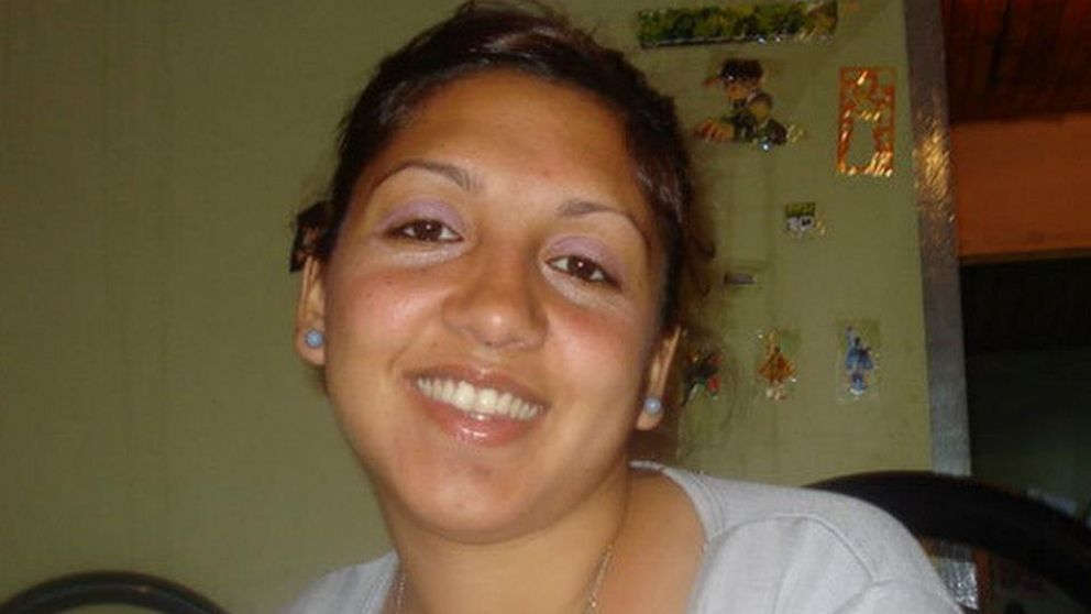 Vanesa Celma estaba embarazada de 8 meses cuando la quemaron.