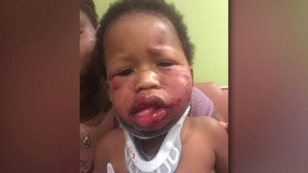 Así quedó el pequeño tras los golpes.