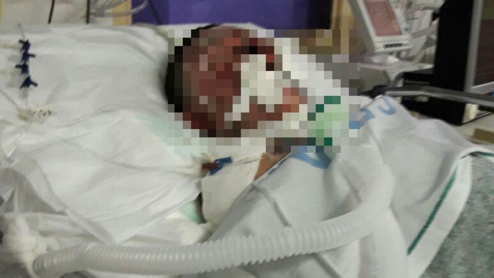 Incendió la casa de su esposa y prendió fuego a su sobrino
