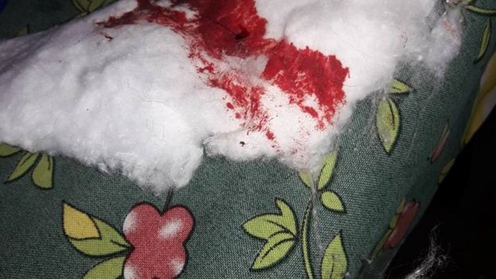 Acuchilló a perrita de su vecina porque le comió el almuerzo