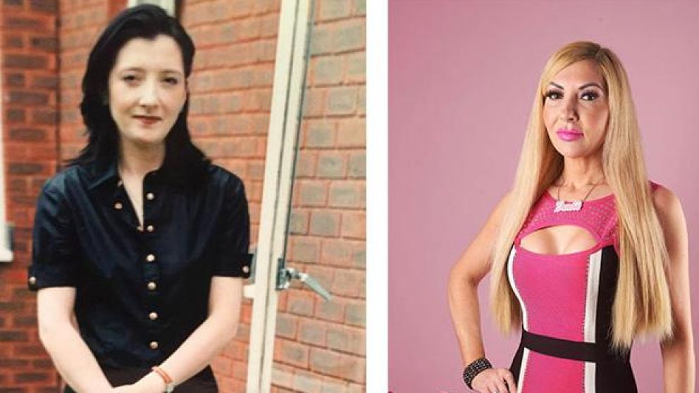 Luego de someterse a m�ltiples cirugias busca a su media naranja.