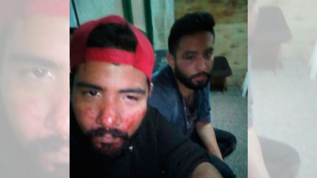 Ariel Croce y Mat�as Villalba fueron salvajemente agredidos por ser gays a la salida de un boliche en Quilmes.