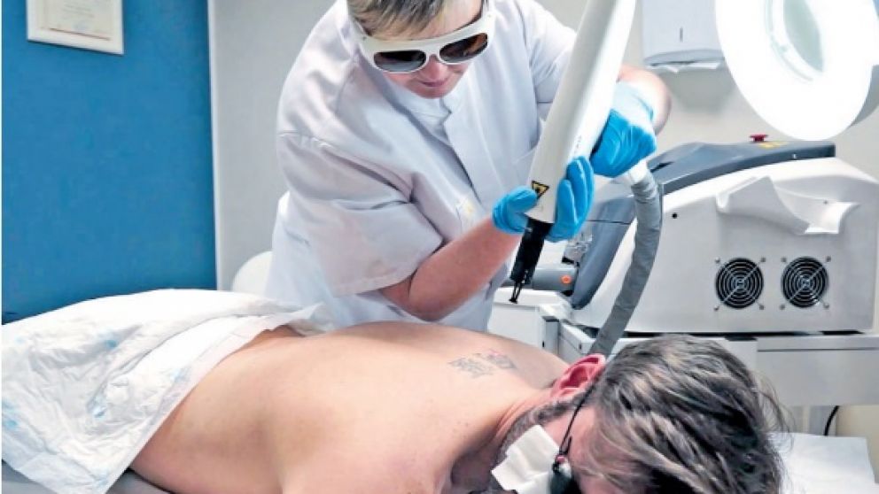 Nuevas opciones para quienes se arrepienten de haberse tatuado