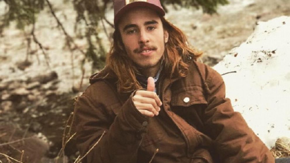 Tomas Lacase, de 20 años, sufrió múltiples fracturas en su rostro.