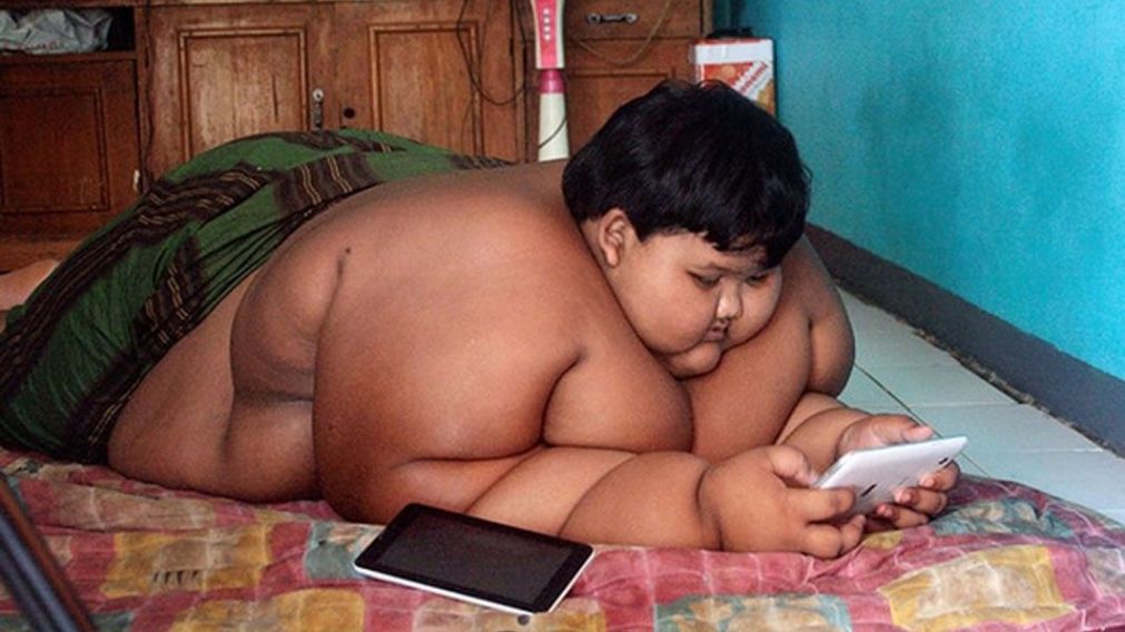 Ya camina "el nene más obeso del mundo"