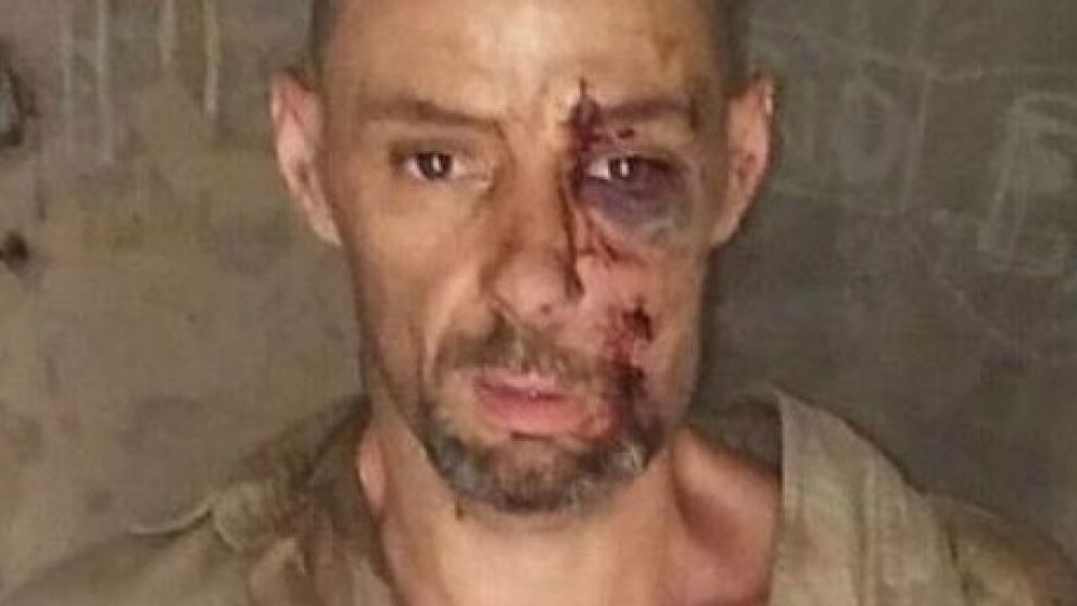 Martín Lanatta, herido al chocar con la camioneta que había robado. (Archivo)