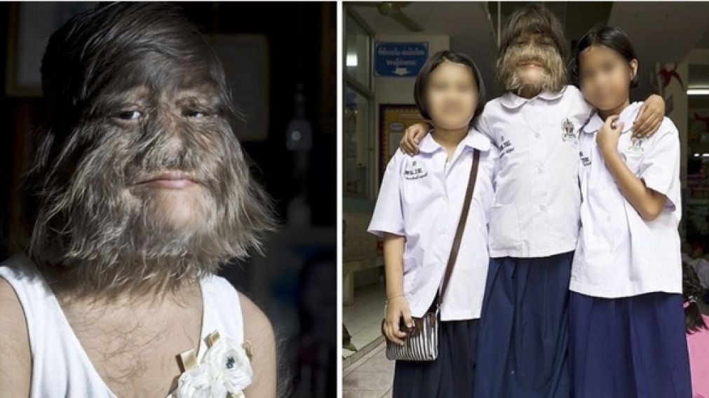 La mujer más peluda cambió de look para casarse.