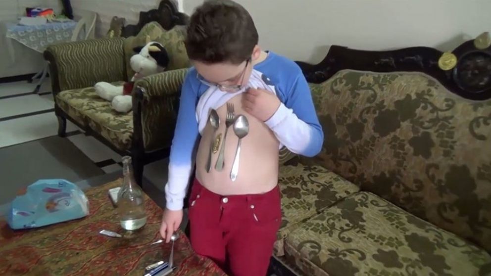 Se le pega todo lo metálico.