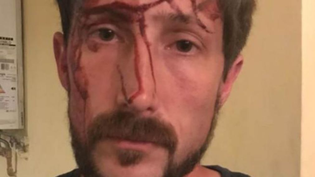 Concejal agredido dijo que la violenta entradera tuvo origen "político"
