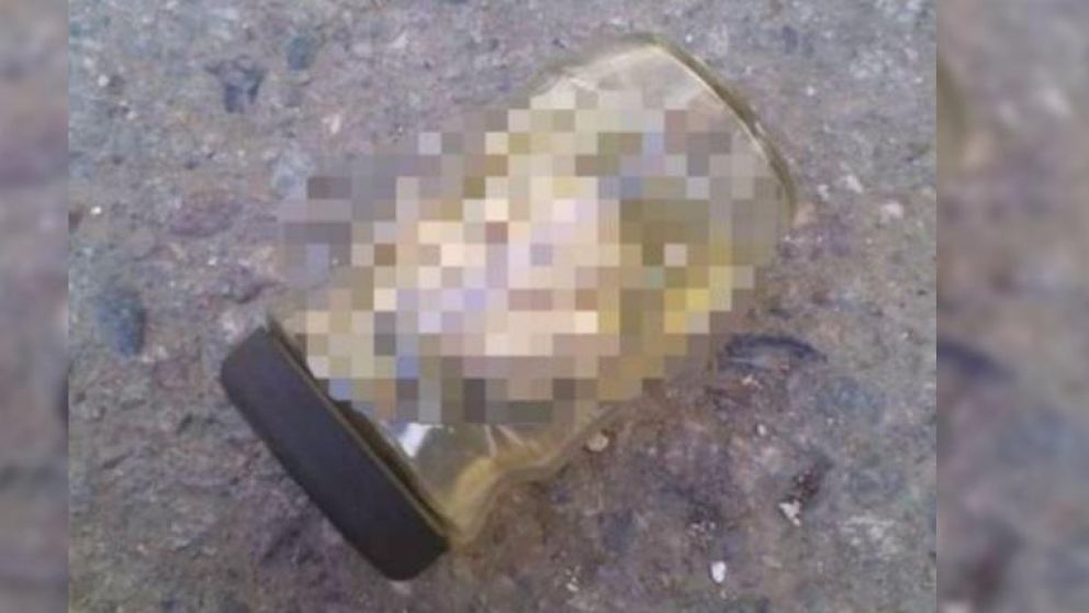 Caminaba por la calle y tropezó con un feto