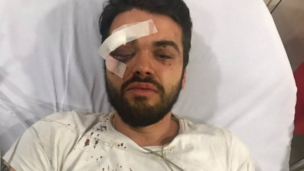 El joven recibió una golpiza por ser gay.