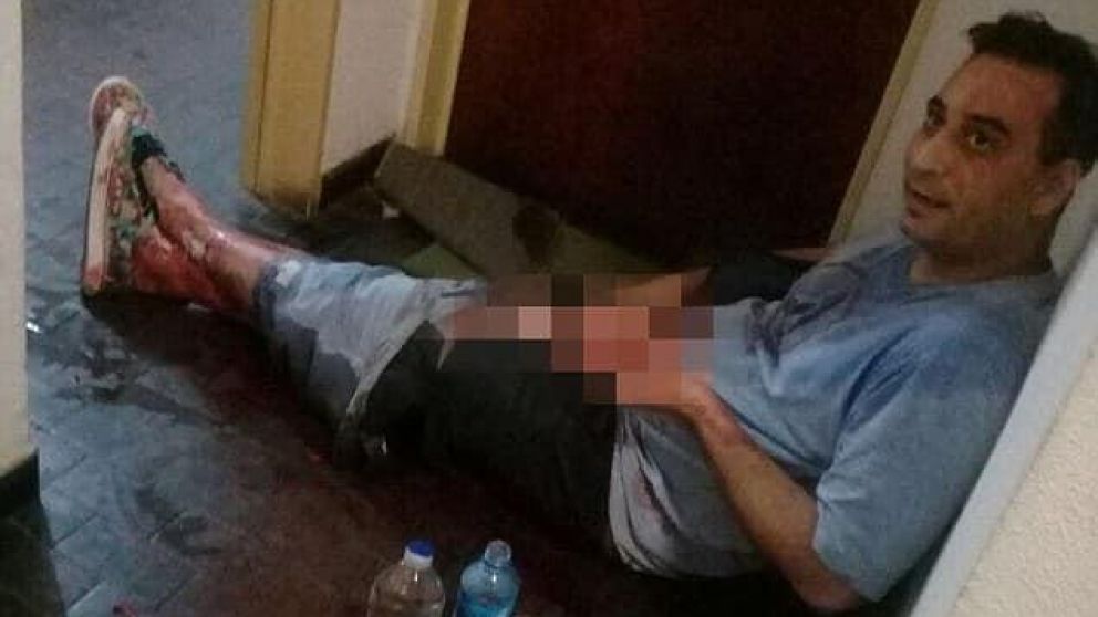 "Estoy feliz de estar vivo", dijo el hombre del miembro cortado