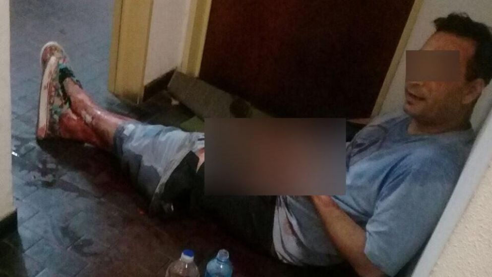 Le amputó el pene a su amante con tijera de podar