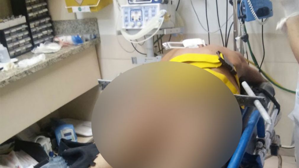 Intent� robar un local y una reja le atraves� la nalga