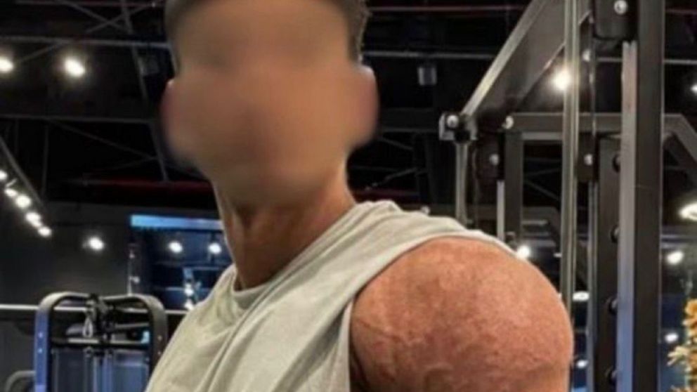 Un fisicoculturista de La Plata fue detenido acusado de someter a su novia a un episodio de violencia de género.