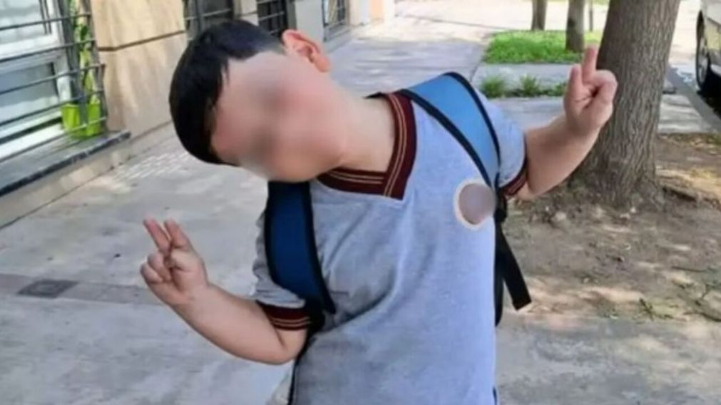El nene de 8 años sigue internado.
