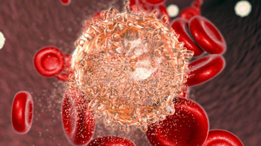 El Ministerio de Salud de la Nación Nación avanza en la compra de medicación oncológica para una nena de Santa Fe.