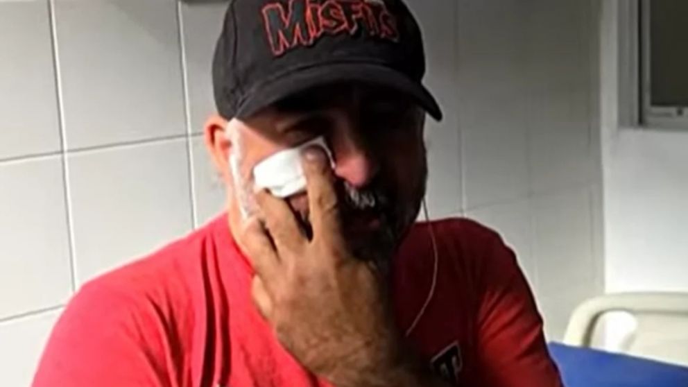 Facundo Tedeschini fue agredido por la Policía Federal y debió recibir atención médica.