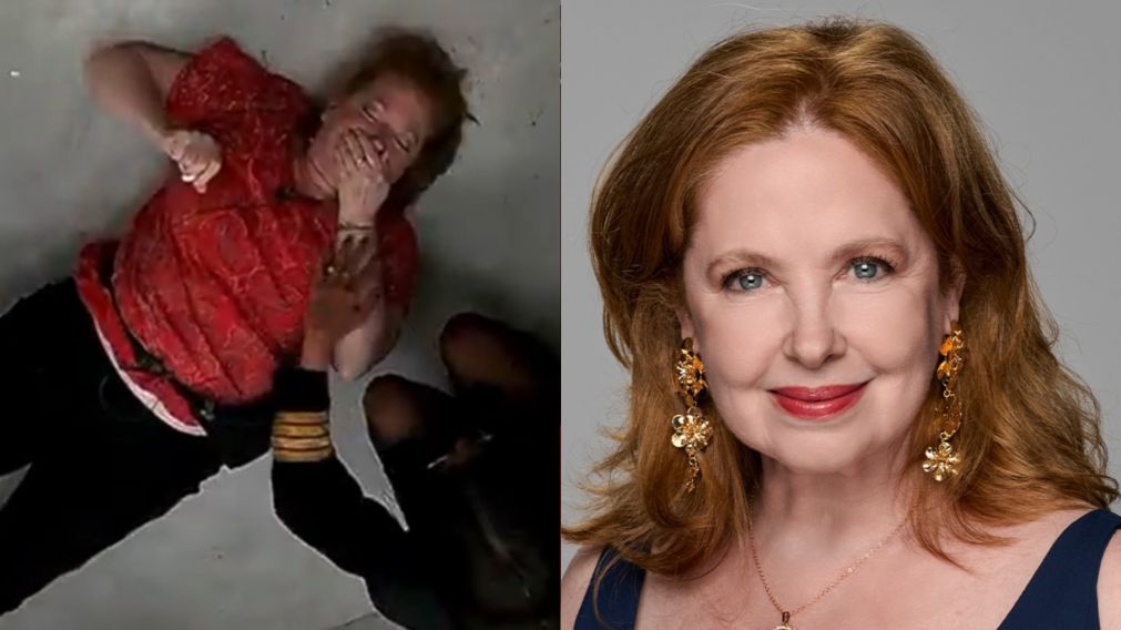 Andrea del Boca reapareci� tras su accidente en "Gran Hermano": la foto de su labio que impact� a todos.