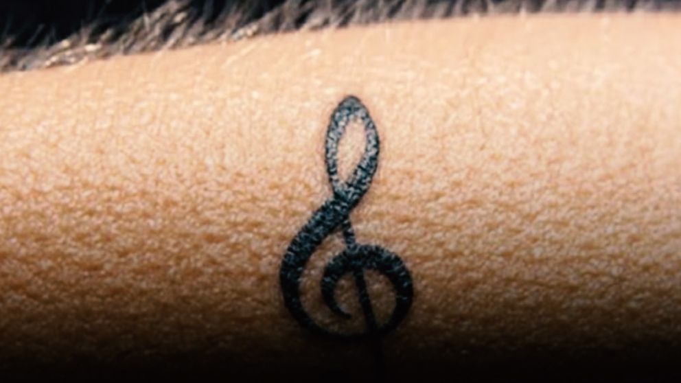 "Frisson": la condici�n que explica por qu� algunas canciones te ponen la piel de gallina