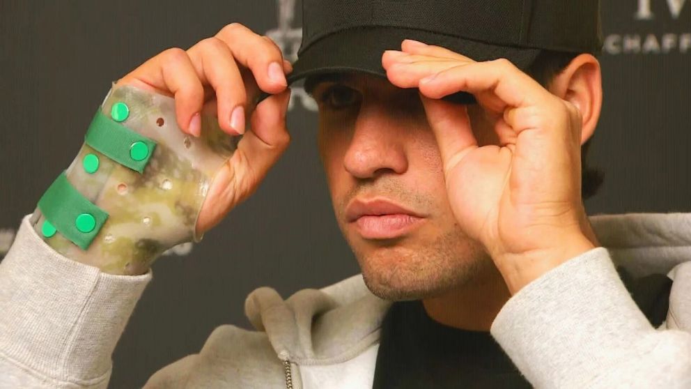 Carlos Alcaraz sigue lesionado de la mu�eca y por ese motivo ha perdido much�simos puntos en el ranking ATP.